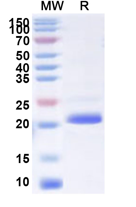 SDS-PAGE for Recombinant Human POLE3 Protein, N-His