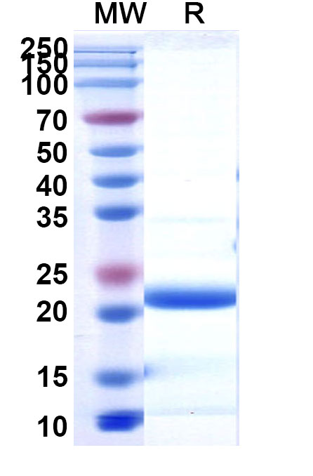 SDS-PAGE for Recombinant Human PON1, N-His