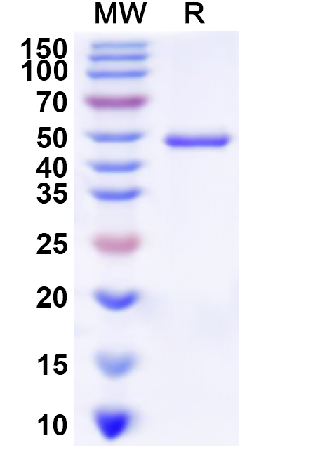 SDS-PAGE for Recombinant Human PPM1F Protein, N-His