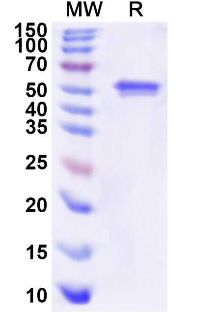 SDS-PAGE for Recombinant Human PPOX Protein, N-His
