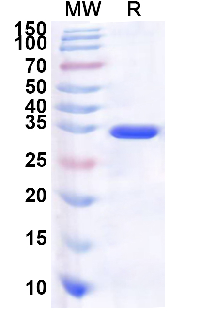 SDS-PAGE for Recombinant Human PPP1R7 Protein, N-His