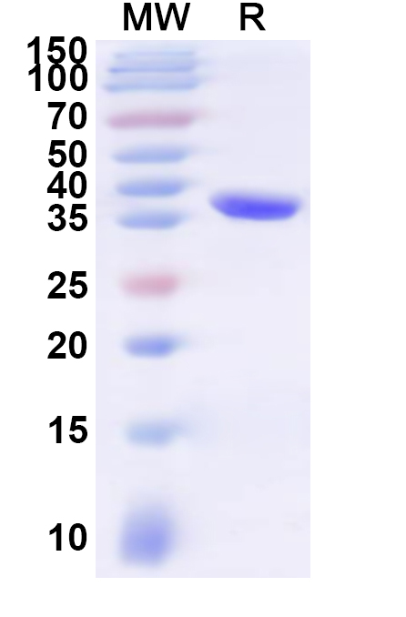 SDS-PAGE for Recombinant Human PRAP1 Protein, N-His-KSI