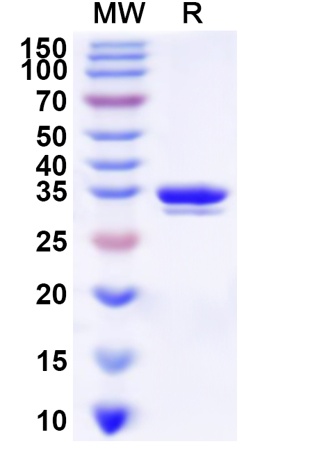 SDS-PAGE for Recombinant Human PRIM2 Protein, N-His