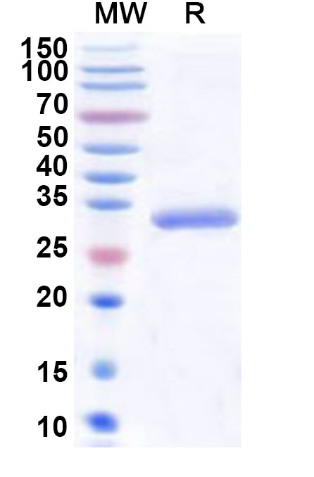 SDS-PAGE for Recombinant Human PRKACG Protein, N-His