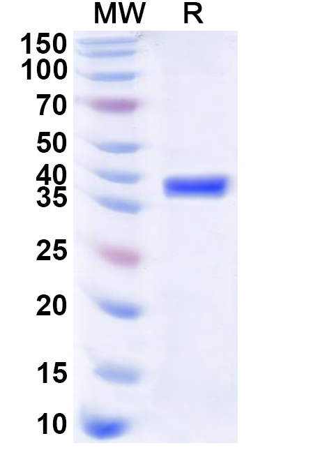 SDS-PAGE for Recombinant Human PRKAR2B Protein, N-His