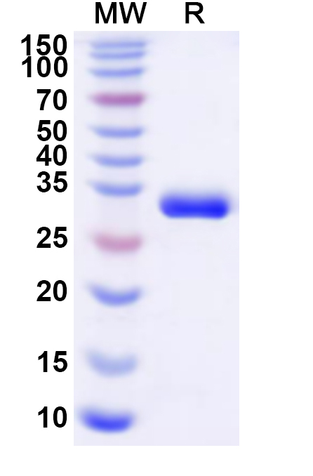 SDS-PAGE for Recombinant Human PRKCH Protein, N-His