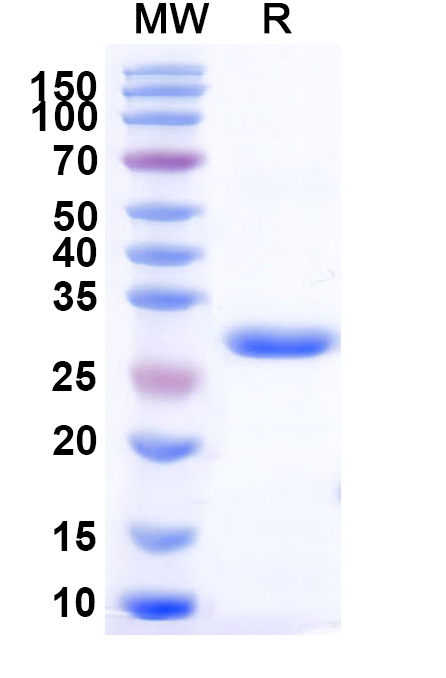 SDS-PAGE for Recombinant Human PRSS2 Protein, N-His