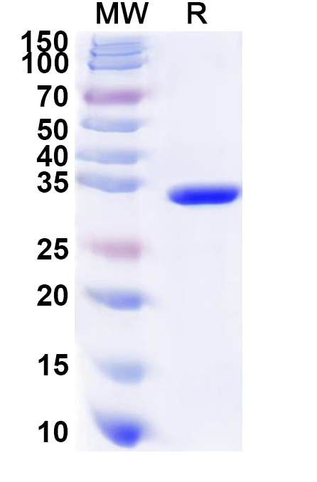 SDS-PAGE for Recombinant Human PSMA1 Protein, N-His