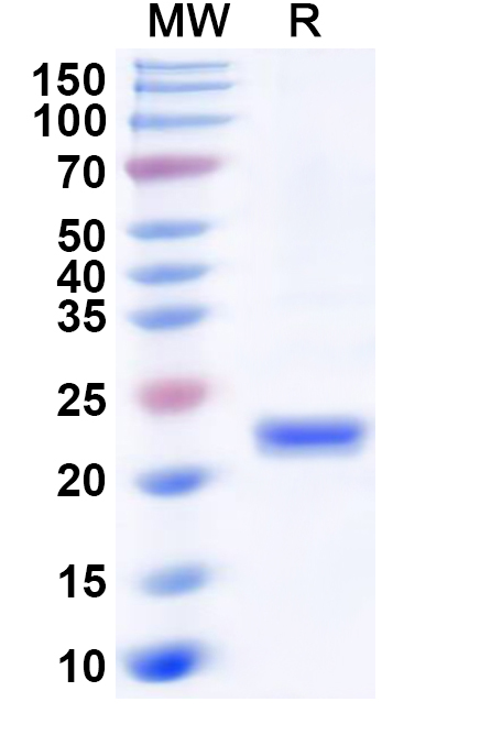 SDS-PAGE for Recombinant Human PSMB10 Protein, N-His