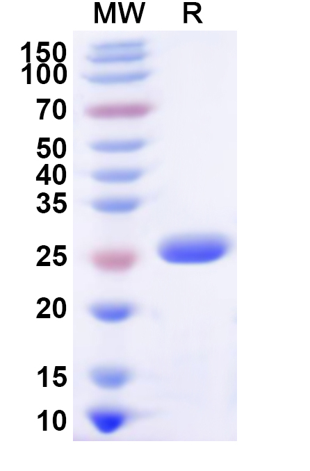 SDS-PAGE for Recombinant Human PSMB3 Protein, N-His