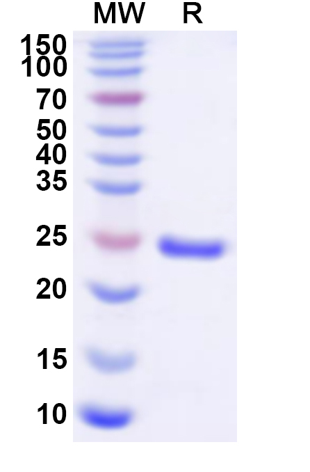 SDS-PAGE for Recombinant Human PSMB4 Protein, N-His