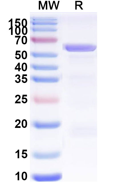 SDS-PAGE for Recombinant Human PSMC1, N-His
