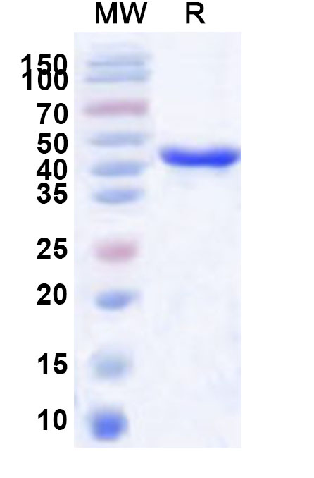 SDS-PAGE for Recombinant Human PSMC5 Protein, N-His