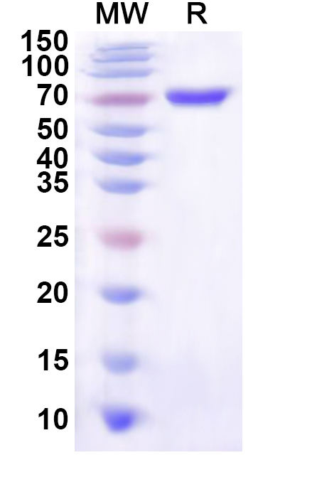 SDS-PAGE for Recombinant Human PSRC1 Protein, N-His-KSI