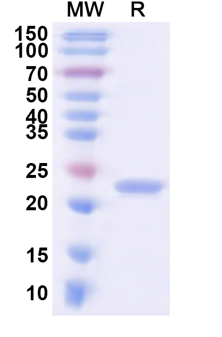 SDS-PAGE for Recombinant Human PTDSS1 Protein, N-His-KSI