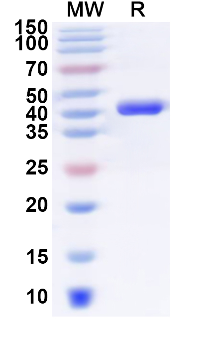 SDS-PAGE for Recombinant Human PTER Protein, N-His