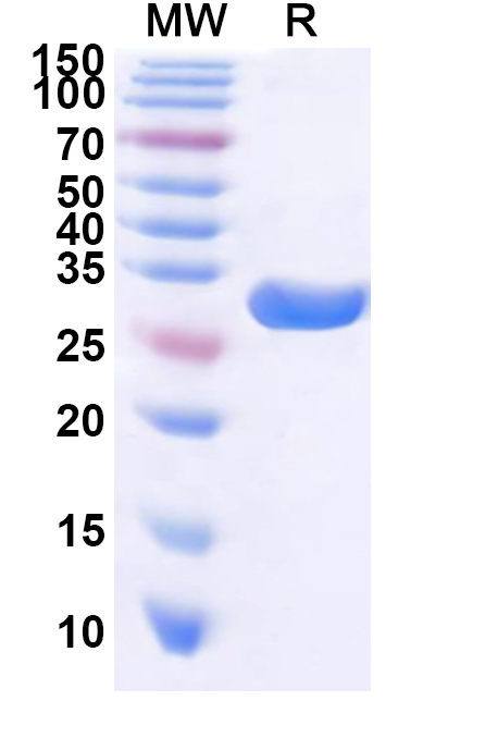 SDS-PAGE for Recombinant Human PTGS1 Protein, N-His
