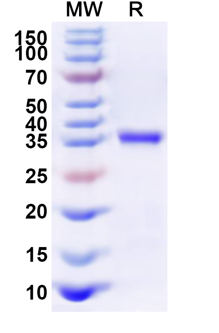 SDS-PAGE for Recombinant Human PTPN3 Protein, N-His