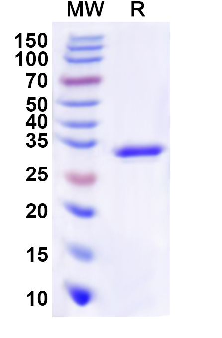 SDS-PAGE for Recombinant Human PTPN4 Protein, N-His