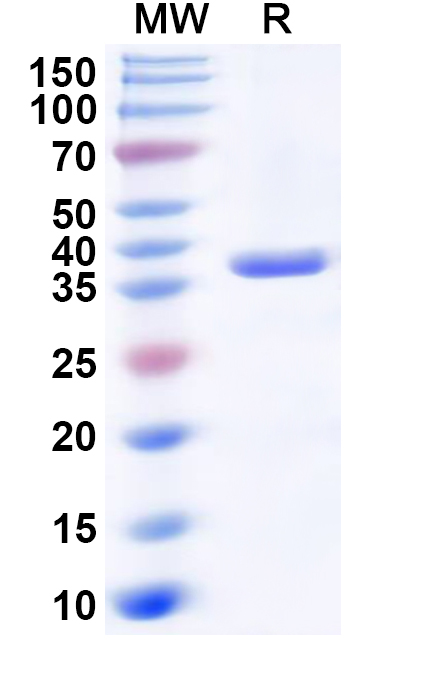 SDS-PAGE for Recombinant Human PTPN7 Protein, N-His