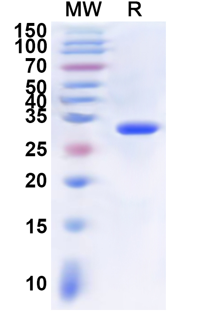 SDS-PAGE for Recombinant Human QPRT Protein, N-His