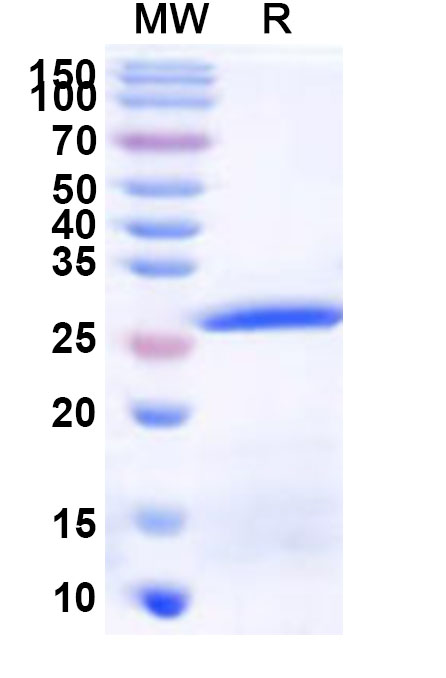 SDS-PAGE for Recombinant Human QSOX2 Protein, N-His