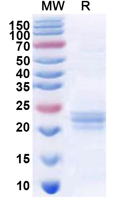 SDS-PAGE for Recombinant Human RAB38 Protein, N-His