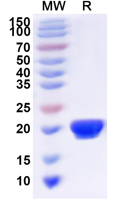 SDS-PAGE for Recombinant Human RAB5C Protein, N-His
