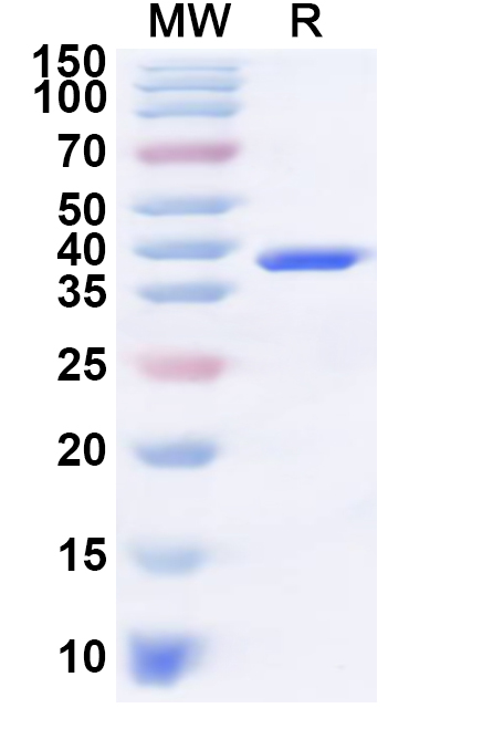 SDS-PAGE for Recombinant Human RABAC1 Protein, N-GST & C-His