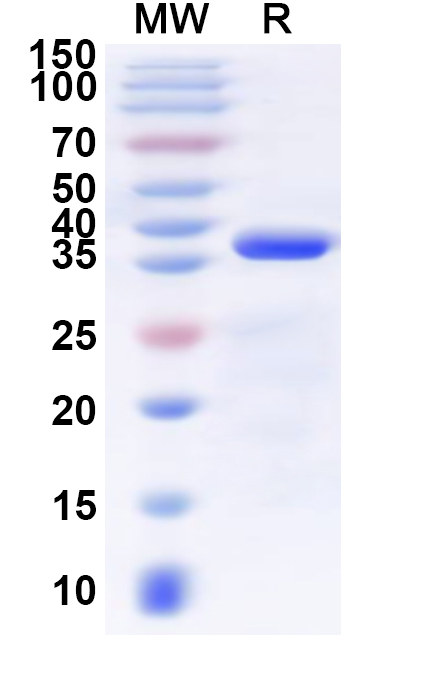 SDS-PAGE for Recombinant Human RANGAP1 Protein, N-His