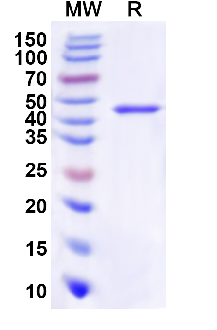 SDS-PAGE for Recombinant Human RAP1GAP Protein, N-His