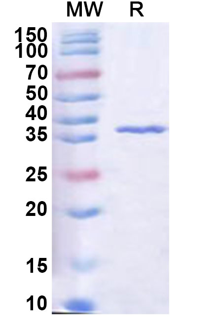 SDS-PAGE for Recombinant Human RASSF2 Protein, N-His