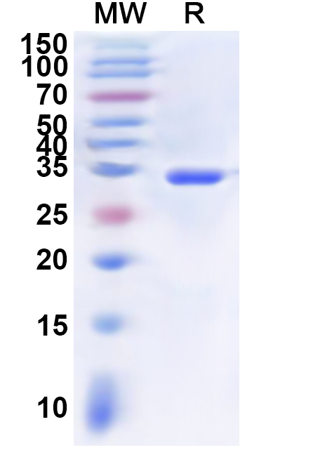 SDS-PAGE for Recombinant Human RBBP5 Protein, N-His