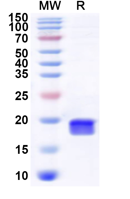SDS-PAGE for Recombinant Human RBM25 Protein, N-His