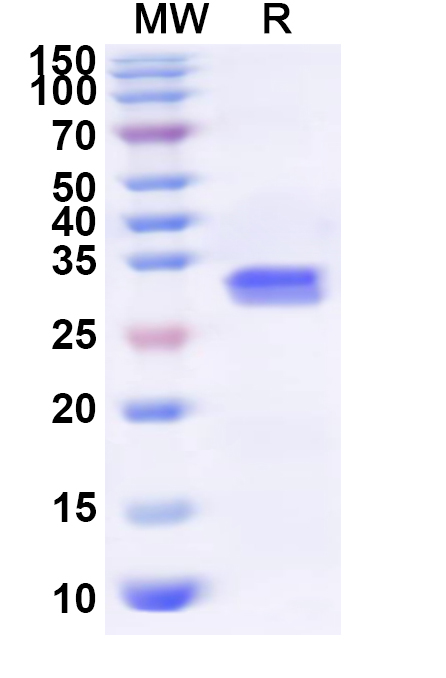 SDS-PAGE for Recombinant Human RBM5 Protein, N-His
