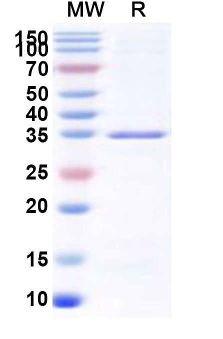 SDS-PAGE for Recombinant Human RBMY1B Protein, N-GST & C-His
