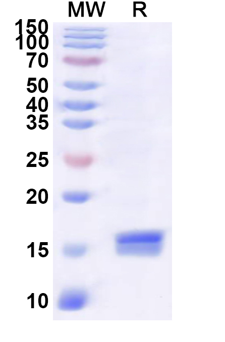 SDS-PAGE for Recombinant Human RGS1 Protein, N-His