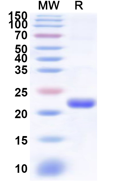 SDS-PAGE for Recombinant Human RING1 Protein, N-His