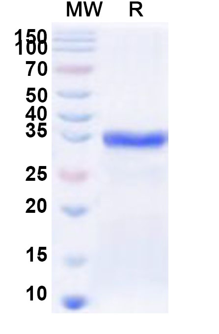 SDS-PAGE for Recombinant Human RIPPLY1 Protein, N-His-KSI