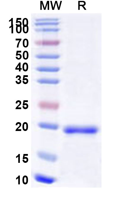 SDS-PAGE for Recombinant Human RNF113A Protein, N-His