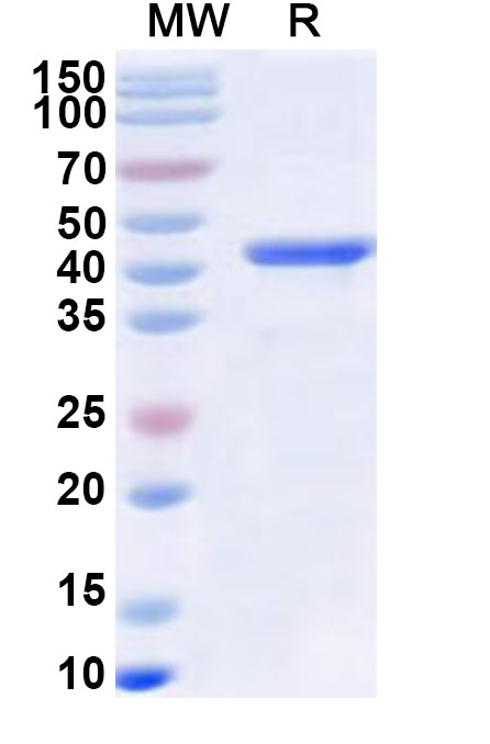 SDS-PAGE for Recombinant Human RNF126 Protein, N-His