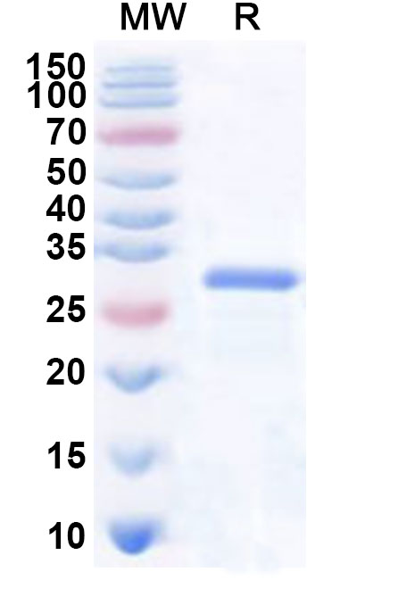 SDS-PAGE for Recombinant Human RNF187 Protein, N-His