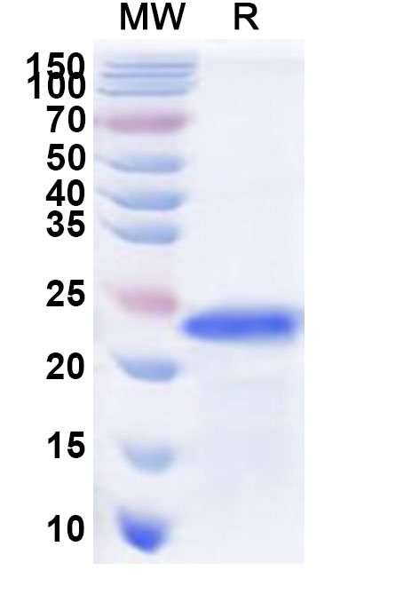 SDS-PAGE for Recombinant Human RNF19B Protein, N-His