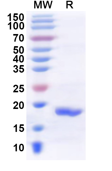 SDS-PAGE for Recombinant Human RNF212 Protein, N-His