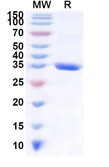 SDS-PAGE for Recombinant Human RNF220 Protein, N-GST & C-His