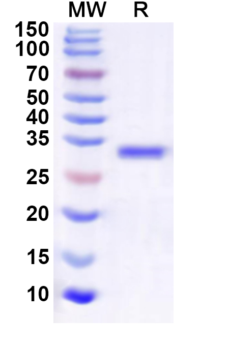 SDS-PAGE for Recombinant Human RNF4 Protein, N-GST & C-His