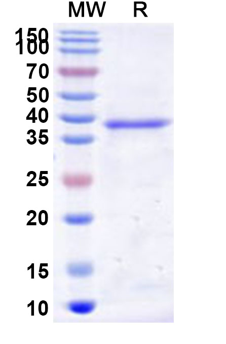 SDS-PAGE for Recombinant Human RNMT Protein, N-His