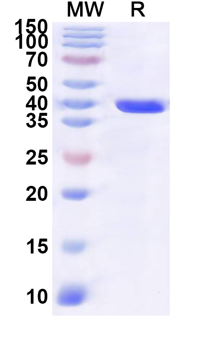 SDS-PAGE for Recombinant Human RNPS1 Protein, N-GST & C-His