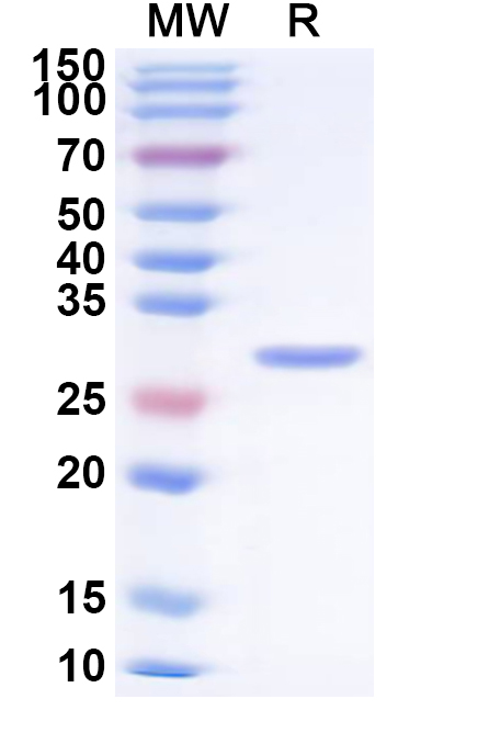 SDS-PAGE for Recombinant Human rotavirus A Outer capsid protein VP4 Protein, N-His