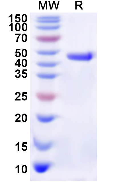 SDS-PAGE for Recombinant Human RPA1 Protein, N-His